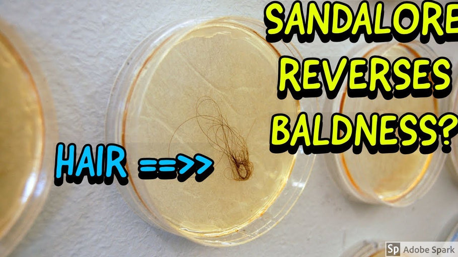 Sandalore Regrows Hair!
